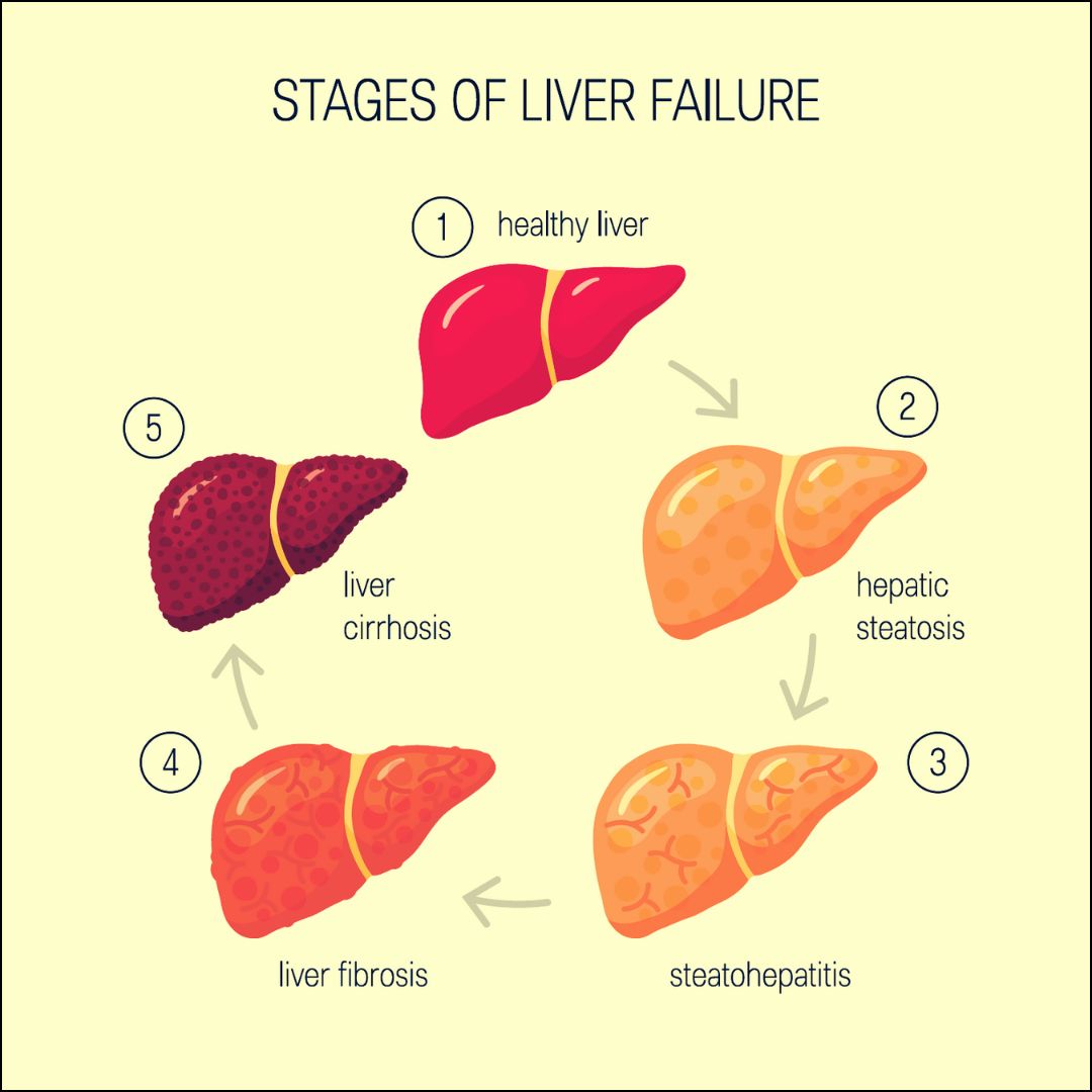 Advanced liver surgery gastroenterologist Vadodara